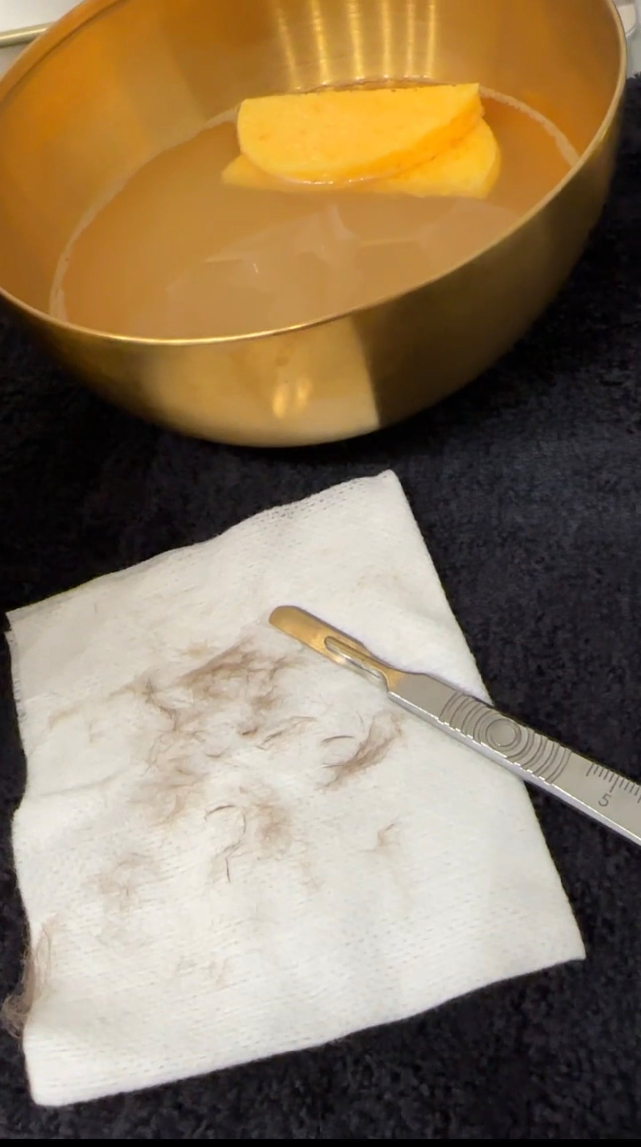 Unveiling the Benefits of Dermaplaning: Debunking the Thicker Hair Myth Introduction